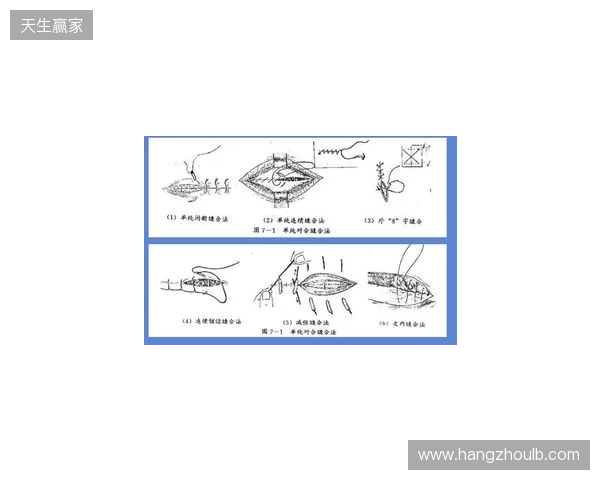广州豹官方:杨浩眉弓伤口缝合30余针,预计5-7天后拆线